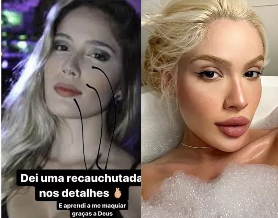 Karoline Lima aparece irreconhecível em foto antes de recauchutagem no rosto