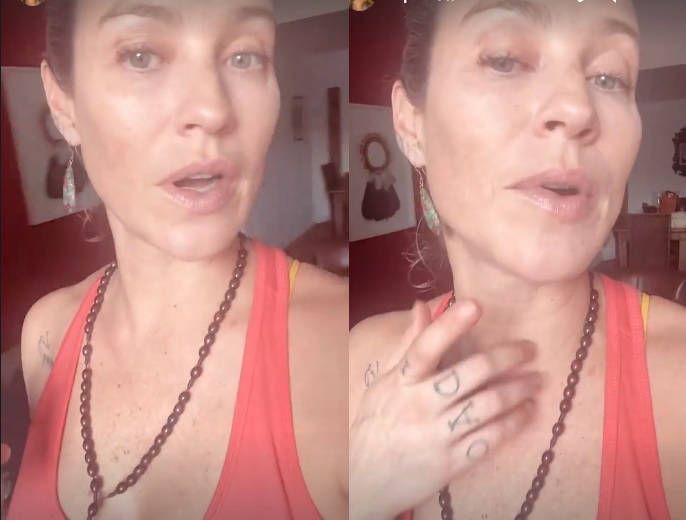 Luana Piovani mostra resultado de harmonização facial