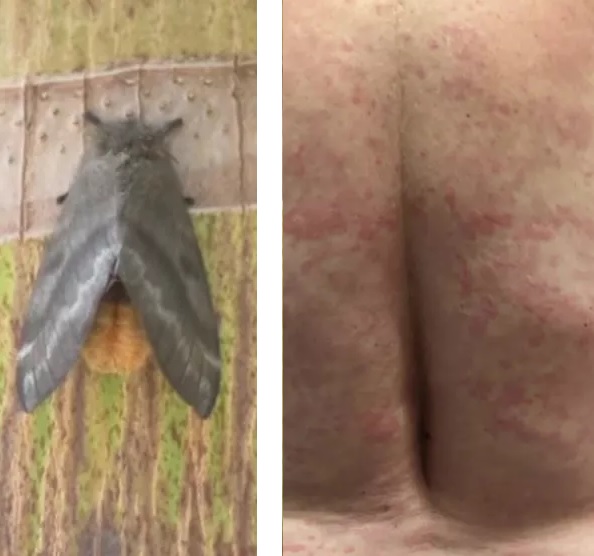 Mariposas que causaram surto no Pernambuco podem ser encontradas em todo o Brasil