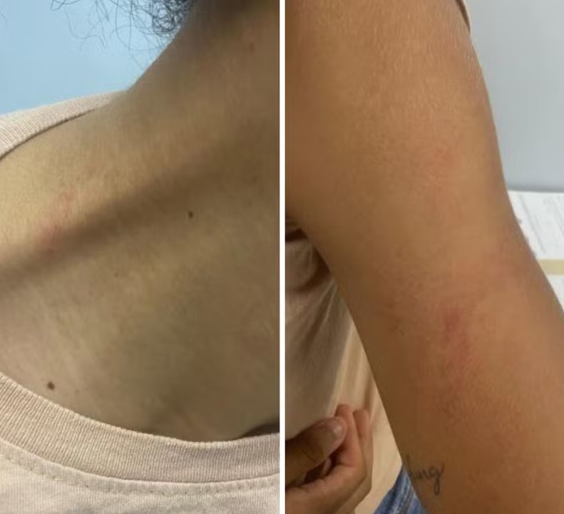 Zagueira do Manaus FC denuncia árbitro de agressão