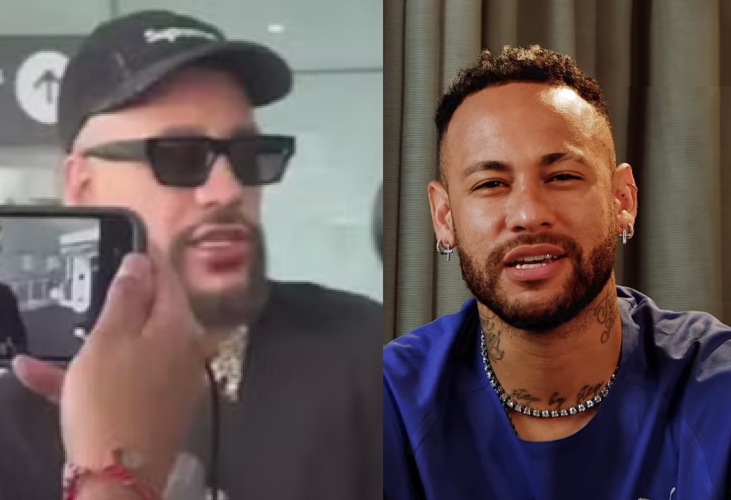 Sósia de Neymar faz rinoplastia para ficar mais parecido com o jogador