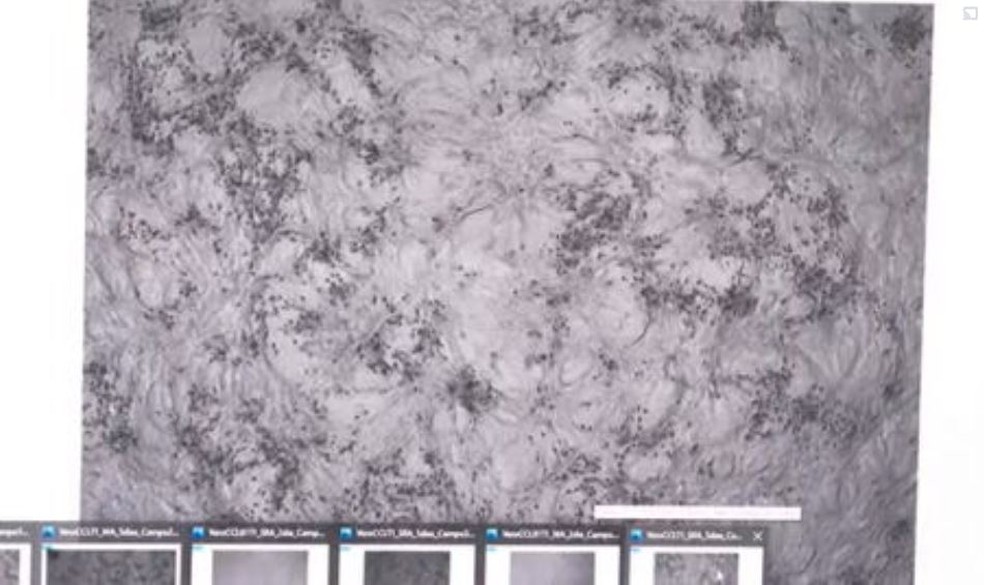 Rio de Janeiro confirma primeiro caso da variante Ômicron