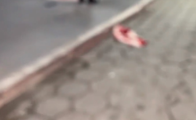 Briga entre vizinhos termina com idoso esfaqueado no pescoço em Manaus