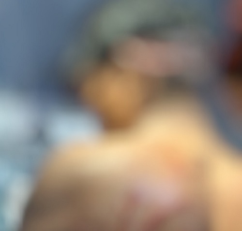 Homem tem cabeça rasgada após sofrer ataque de onça