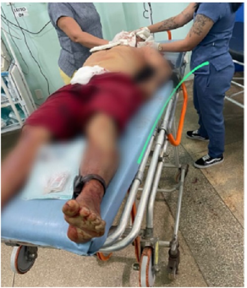 Homem e criança são baleados ao ter casa invadida por criminosos no Amazonas