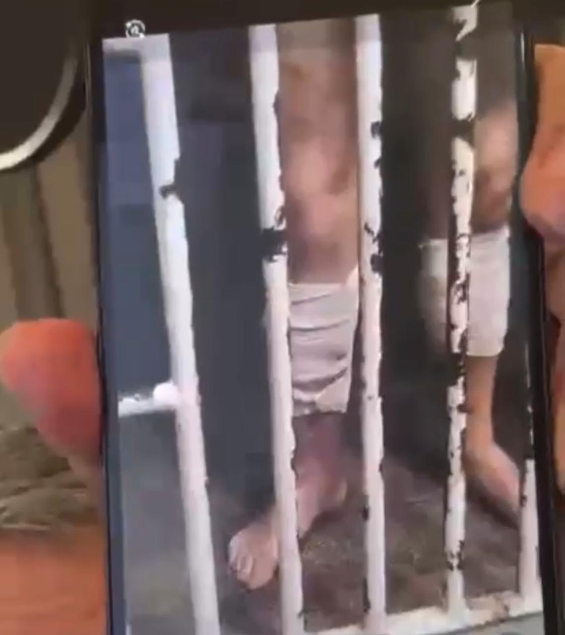 Advogado mostra ferimentos causados pelo uso de Potenay nas pernas de Hatus Silveira 