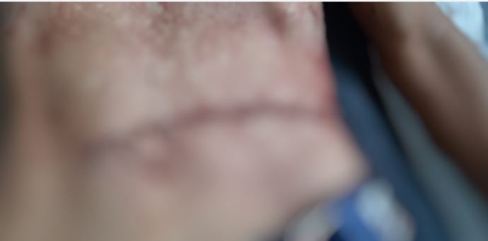 Jovem morre com vísceras arrancadas durante bloco de carnaval no Amazonas