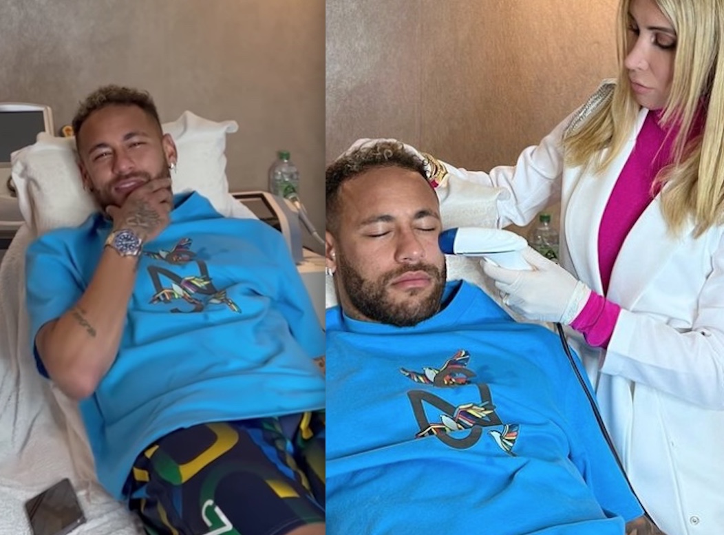 Pele de bebê: Neymar passa por procedimentos estéticos antes da Copa do Mundo