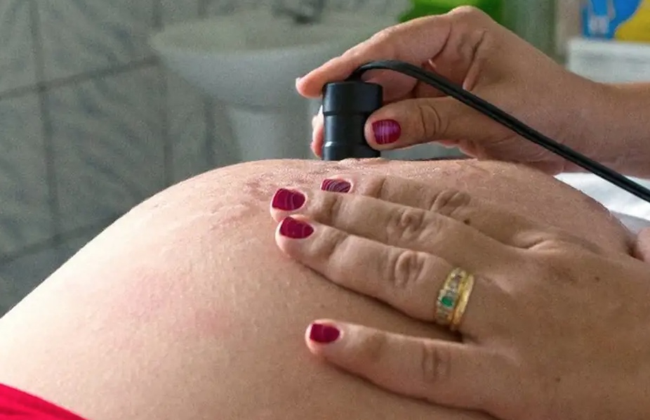 PL obriga hospitais e clínicas a notificarem a polícia por aborto em casos de estupro