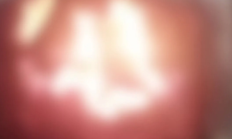 Adolescente queima 5 cães em fornalha, grava vídeo de animais gritando e manda para amigos