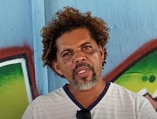 Morador de rua diz que perdoa personal que o agrediu e o aconselha: 'reze e peça sabedoria'