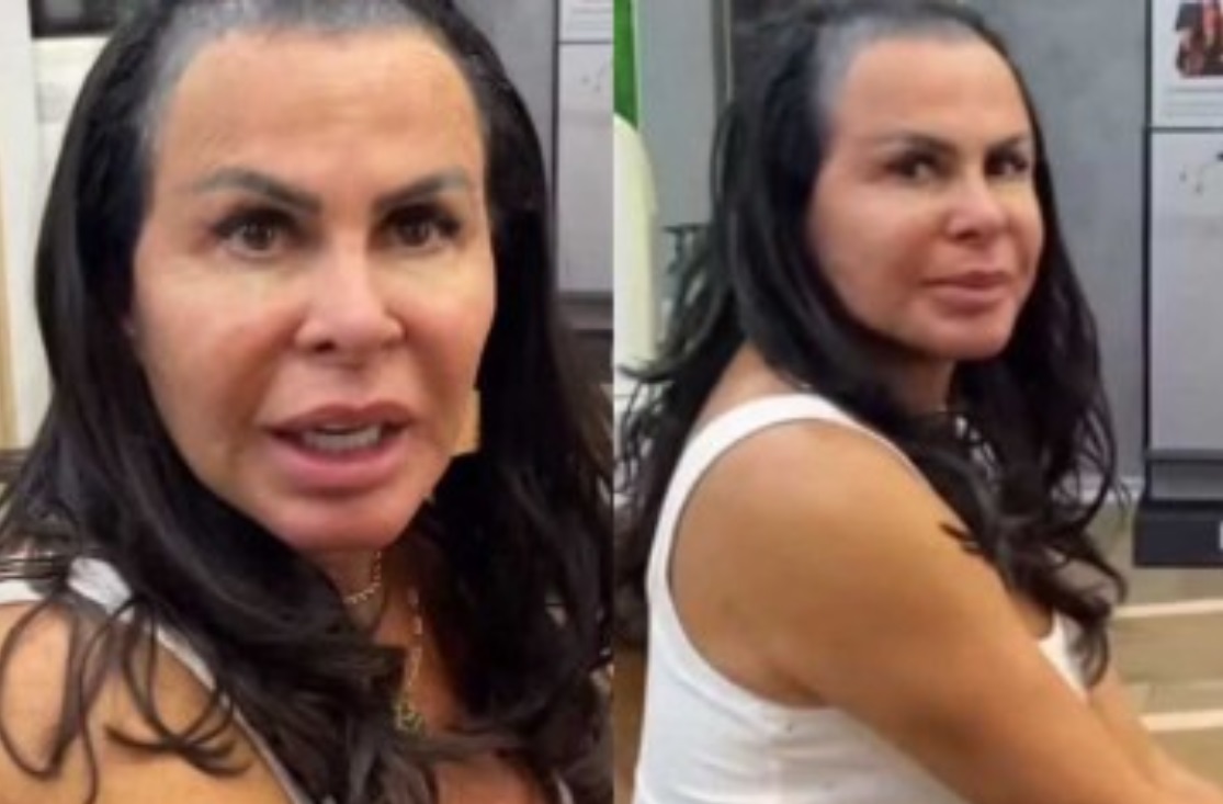 Gretchen surge calva e mostra manutenção nos fios: 'não cresceu mais'