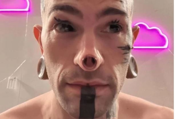 Homem surpreende ao arrancar ponta do nariz e deixar cartilagem à mostra