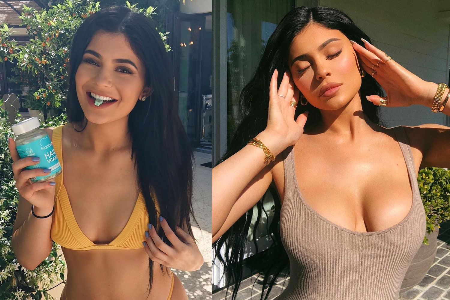 Kylie Jenner admite plástica pela 1ª vez e revela arrependimento: 'eram perfeitos'