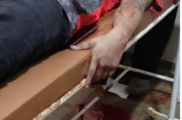 Homem morre ao ter faca cravada na carótida durante briga no Amazonas