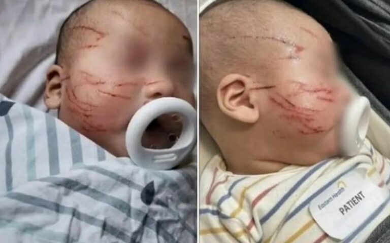Mãe deixa bebê em creche e encontra criança com mais de 20 arranhões no rosto