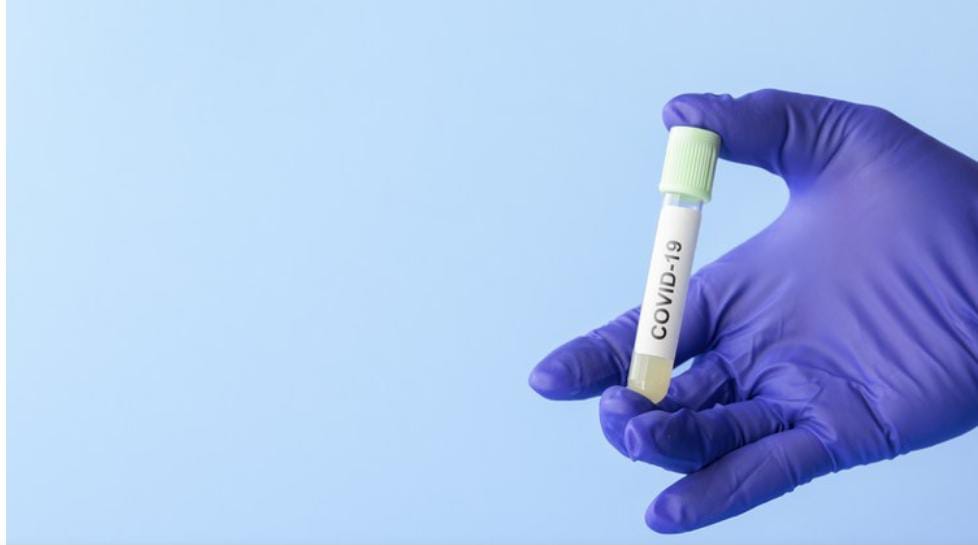 Aleam aprova PL que obriga testagem de professores no Amazonas