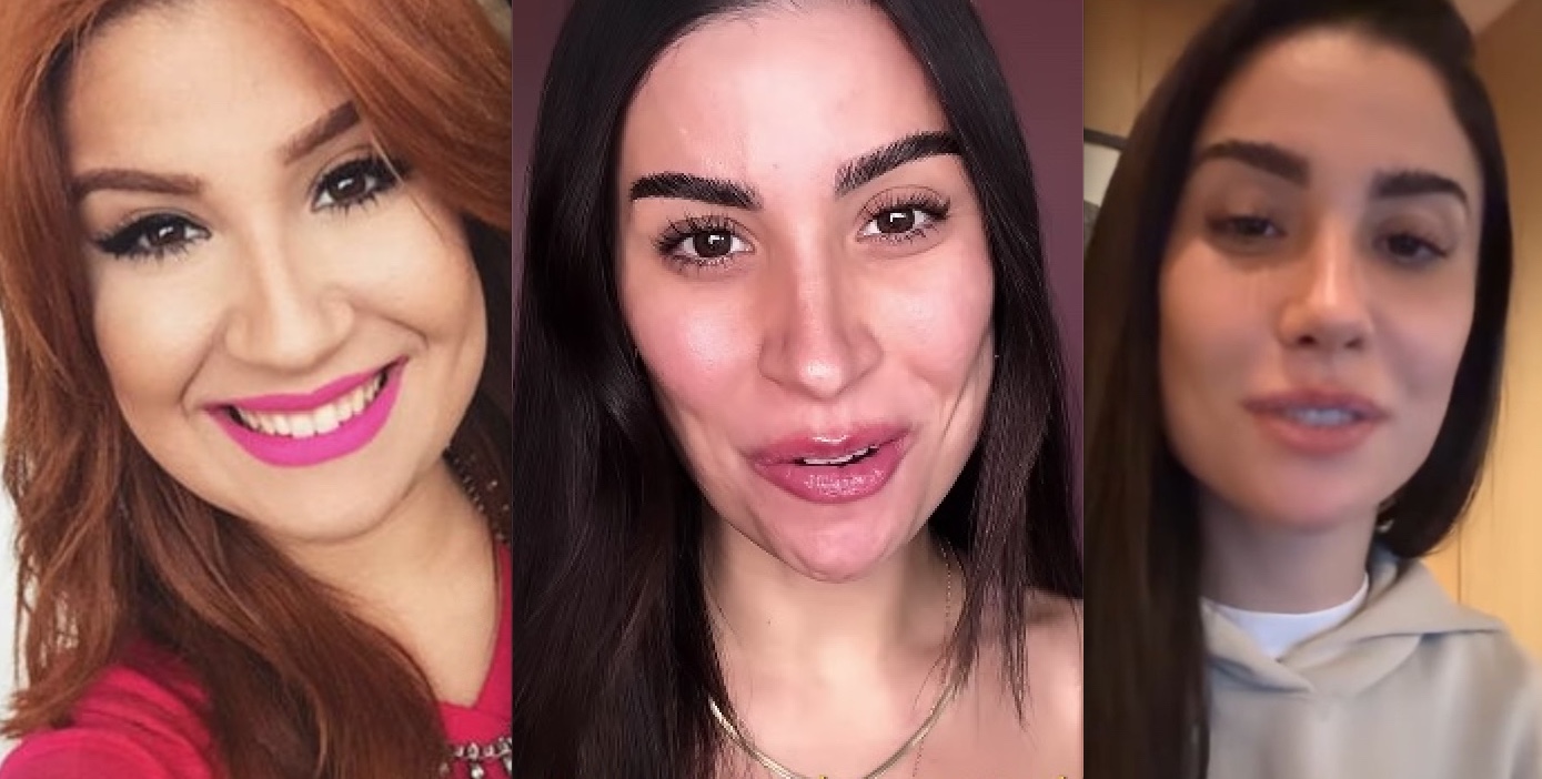 Bianca Andrade surge com nariz empinado após rinoplastia; veja o antes e depois 