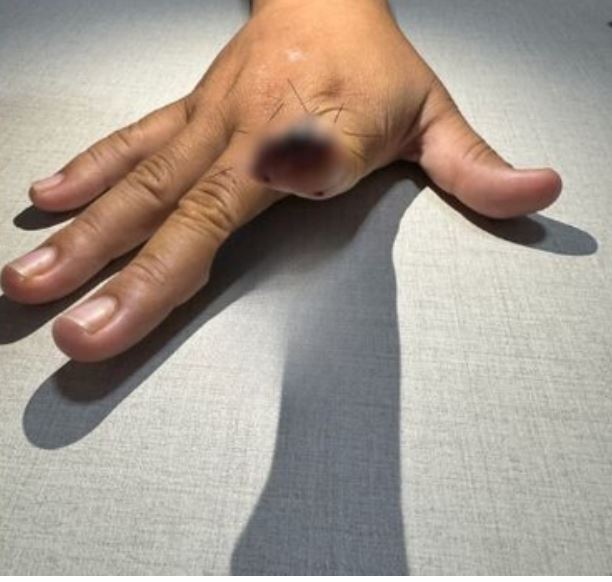 Juiz decide que prisão de homem que arrancou dedo da namorada em Manaus  