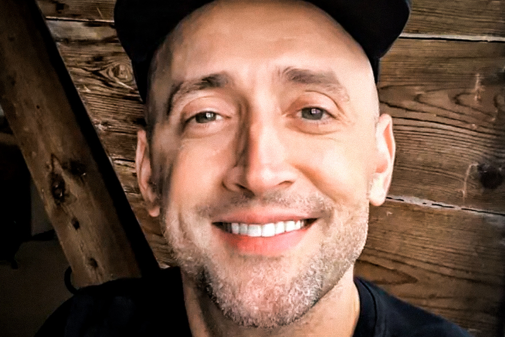 Quadro de Paulo Gustavo é irreversível