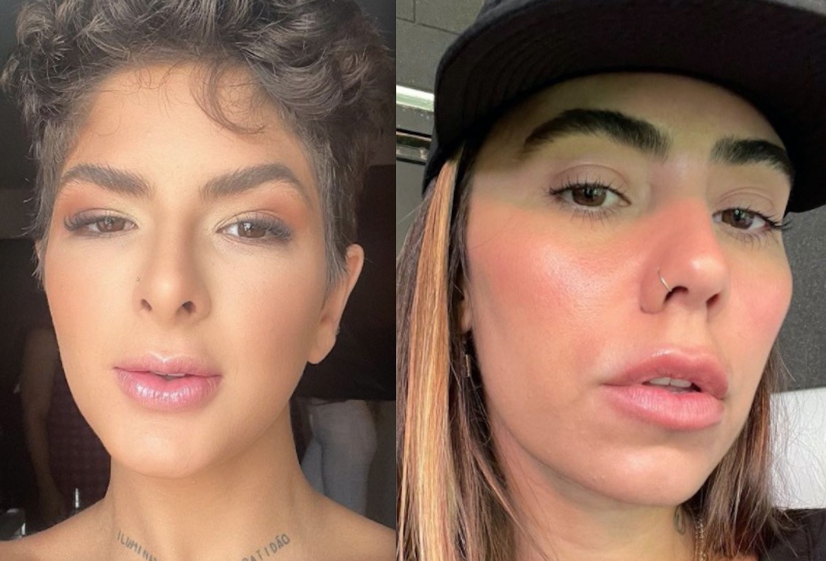 Juntas em balada, amiga diz que não sabia de diagnóstico de covid de Lary Bottino