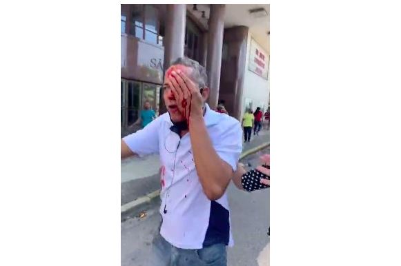 Homem fica cego ao ser atingido por bala de borracha da PM em ato contra Bolsonaro