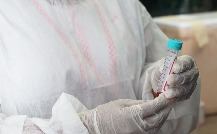 Amazonas registra mais 40 infectados e confirma duas mortes por Covid-19