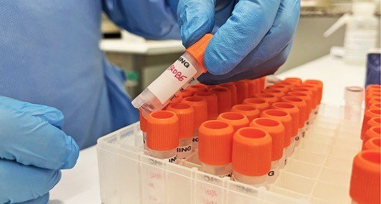 Varíola dos macacos: Anvisa faz recomendações sobre doação de sangue