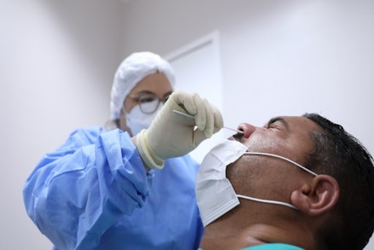 Covid-19: Brasil tem 16,6 mil novos casos e 36 óbitos em 24 horas