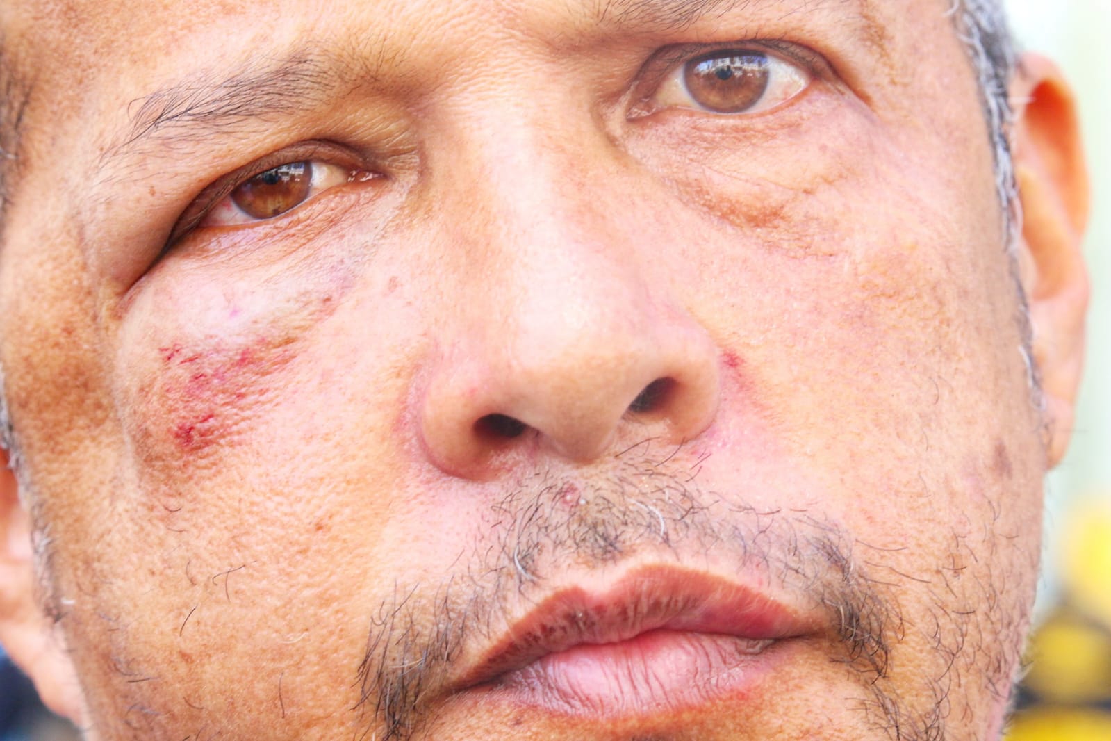 Entregador de app é agredido a socos por cliente em condomínio de luxo em Manaus