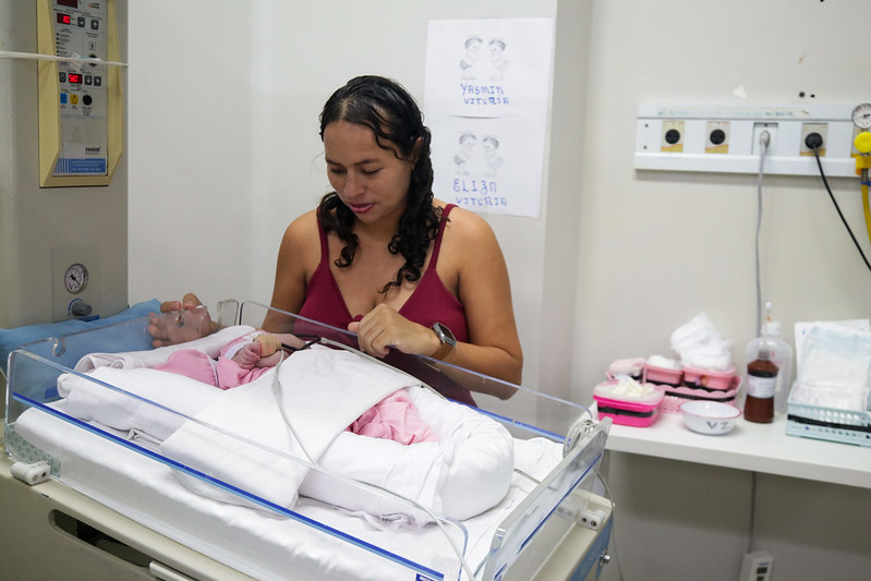 Gêmeas siamesas nascidas em maternidade de Manaus passarão por cirurgia de separação