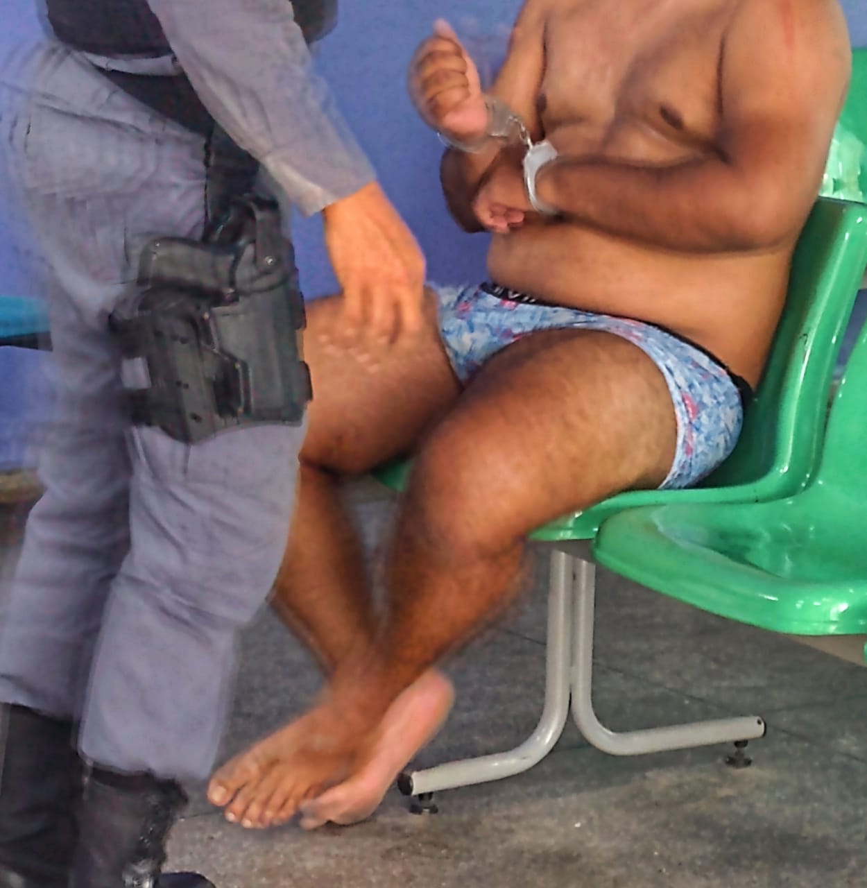 Mulher jogada da escada sofreu ferimento grave e passa por cirurgia em Manaus