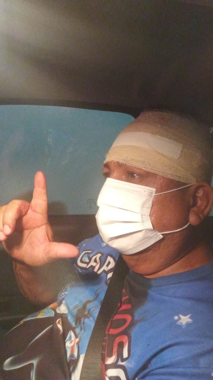 Assessor do deputado Zé Ricardo é agredido com barra de ferro por bolsonarista em Manaus