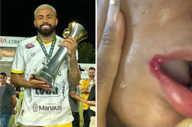 Ex-atacante do Amazonas, DG é acusado de agredir jovem em Belém