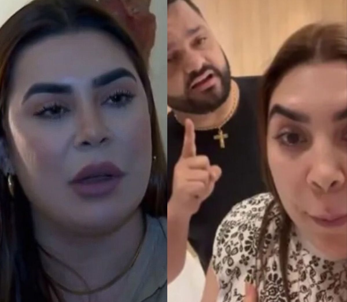 Naiara Azevedo mostra hematomas e diz que ex-marido controlava dinheiro do casal