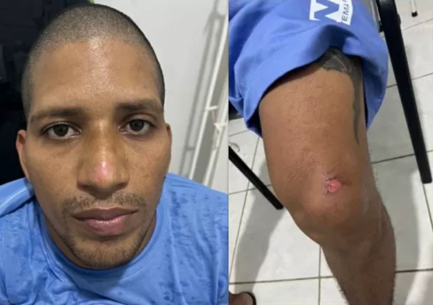 Fugitivo de Mossoró tinha lesões pelo corpo após recaptura, aponta laudo