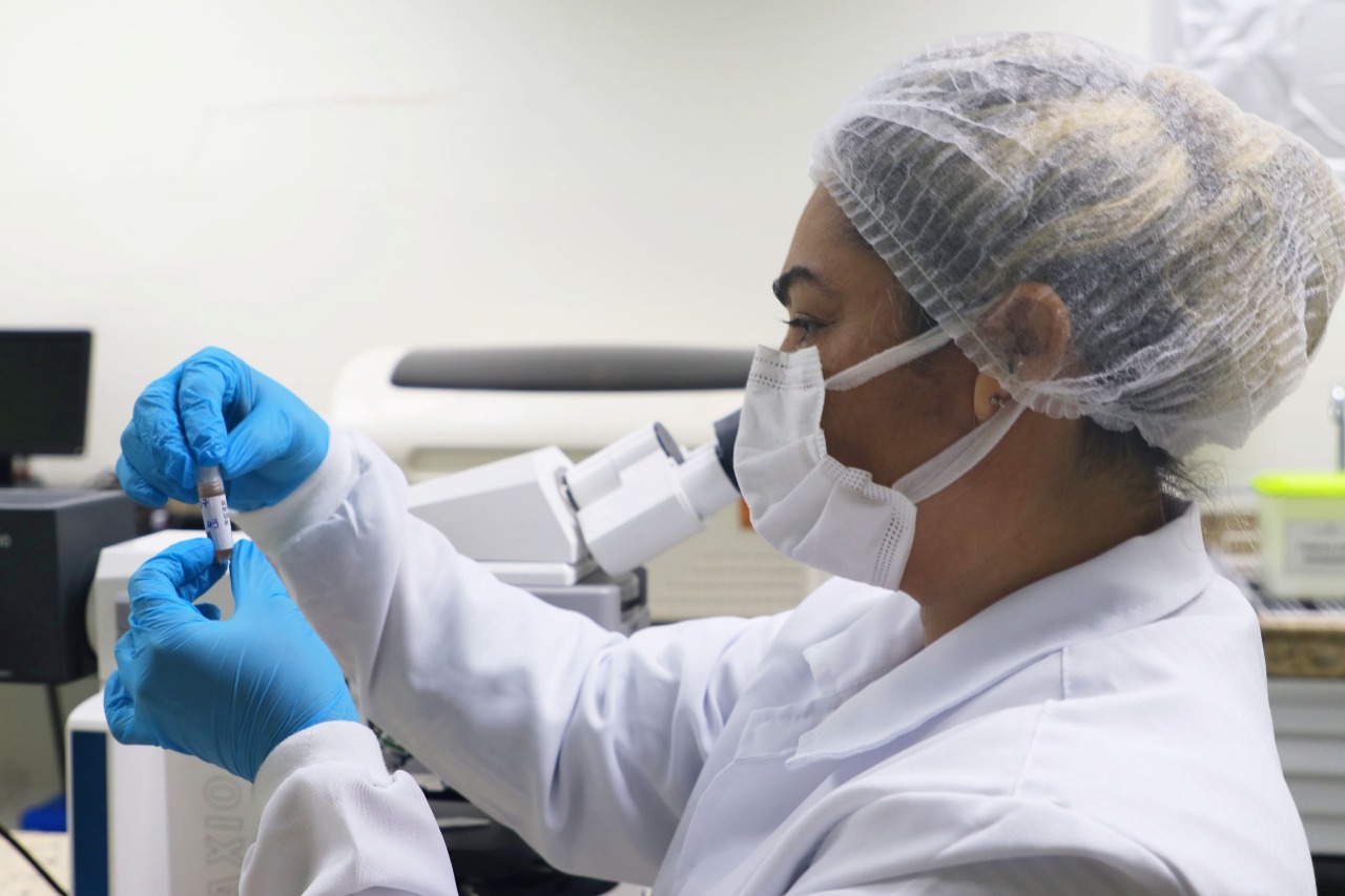 Amazonas tem 22 casos de Mpox confirmados em pacientes homens