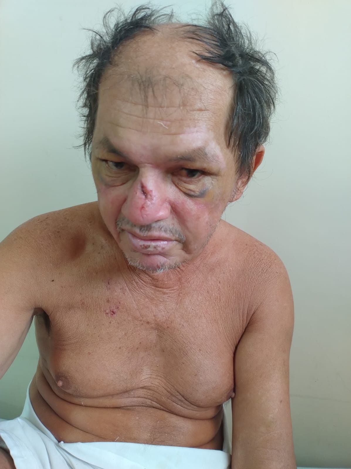 Hospital pede ajuda para localizar familiares de homem atropelado em Manaus