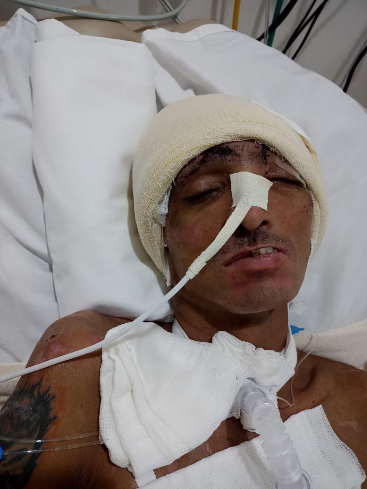 Hospital procura família de paciente internado após ser espancado em Manaus