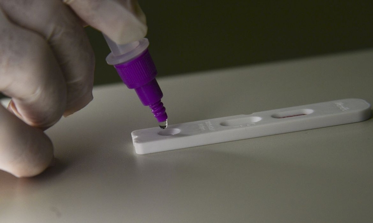 Amazonas registra 103 novos casos de Covid em 24h