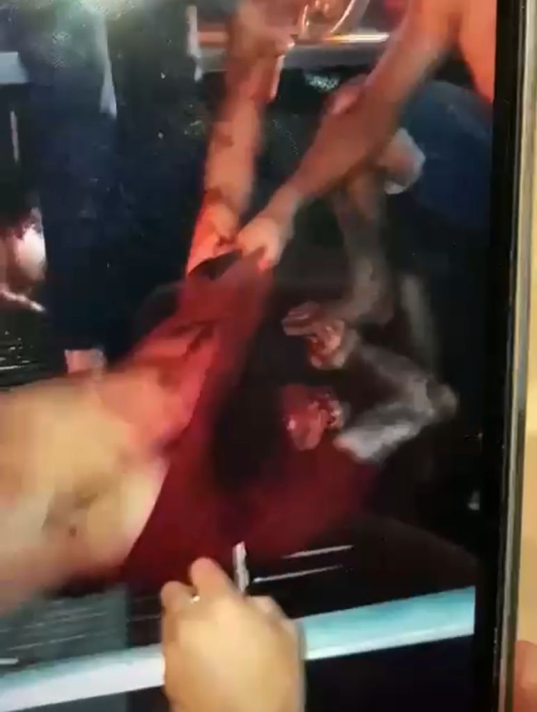 Vídeo: influencer agoniza após ser baleado em velório de cantor de forró no Amazonas