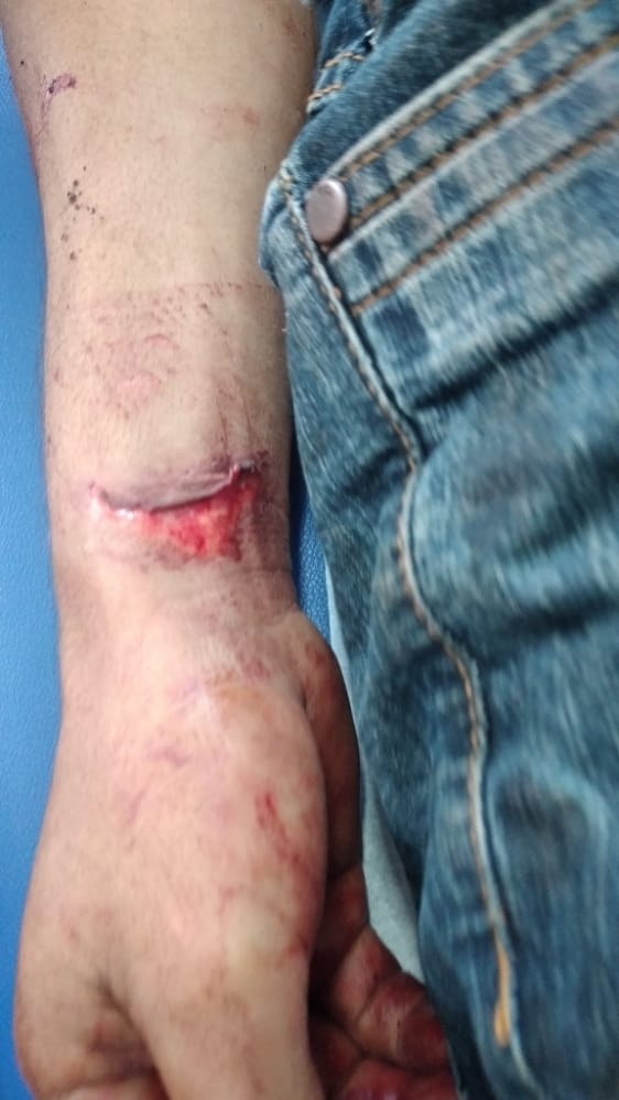 Irmãos são atacados com facão ao tirarem satisfação por morte de porco no Amazonas