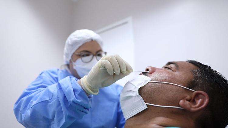 Amazonas registra 134 novos casos de Covid e 2 mortes pela doença