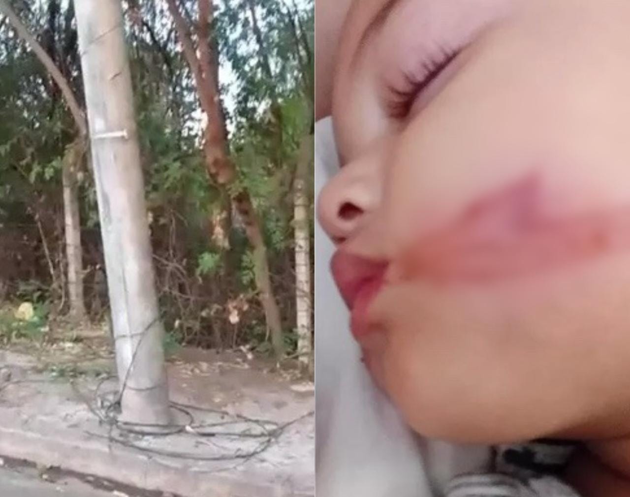 Bebês gêmeos levam 'chicotada' de fio elétrico após carro atingir cabos soltos