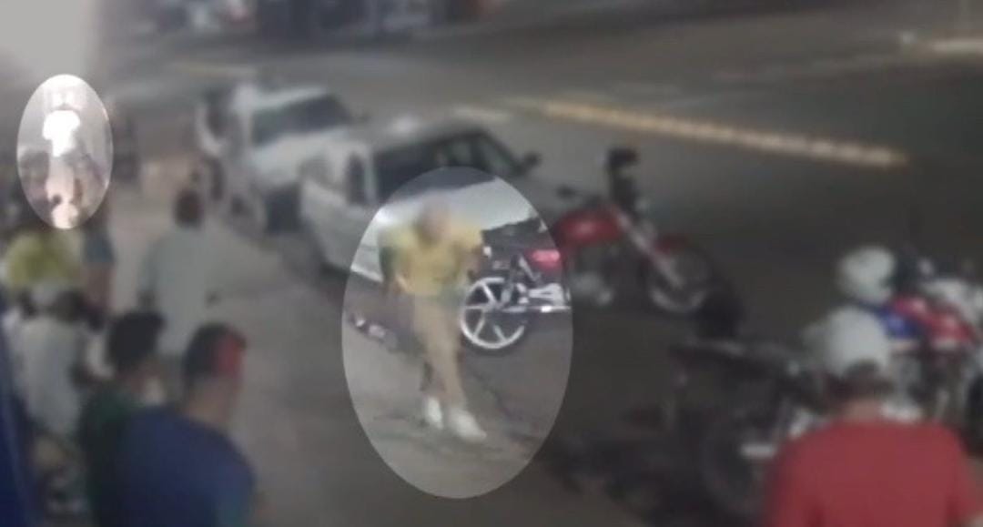 Vídeo: Homem leva tiro que atravessa nuca e sai pela boca e sobrevive