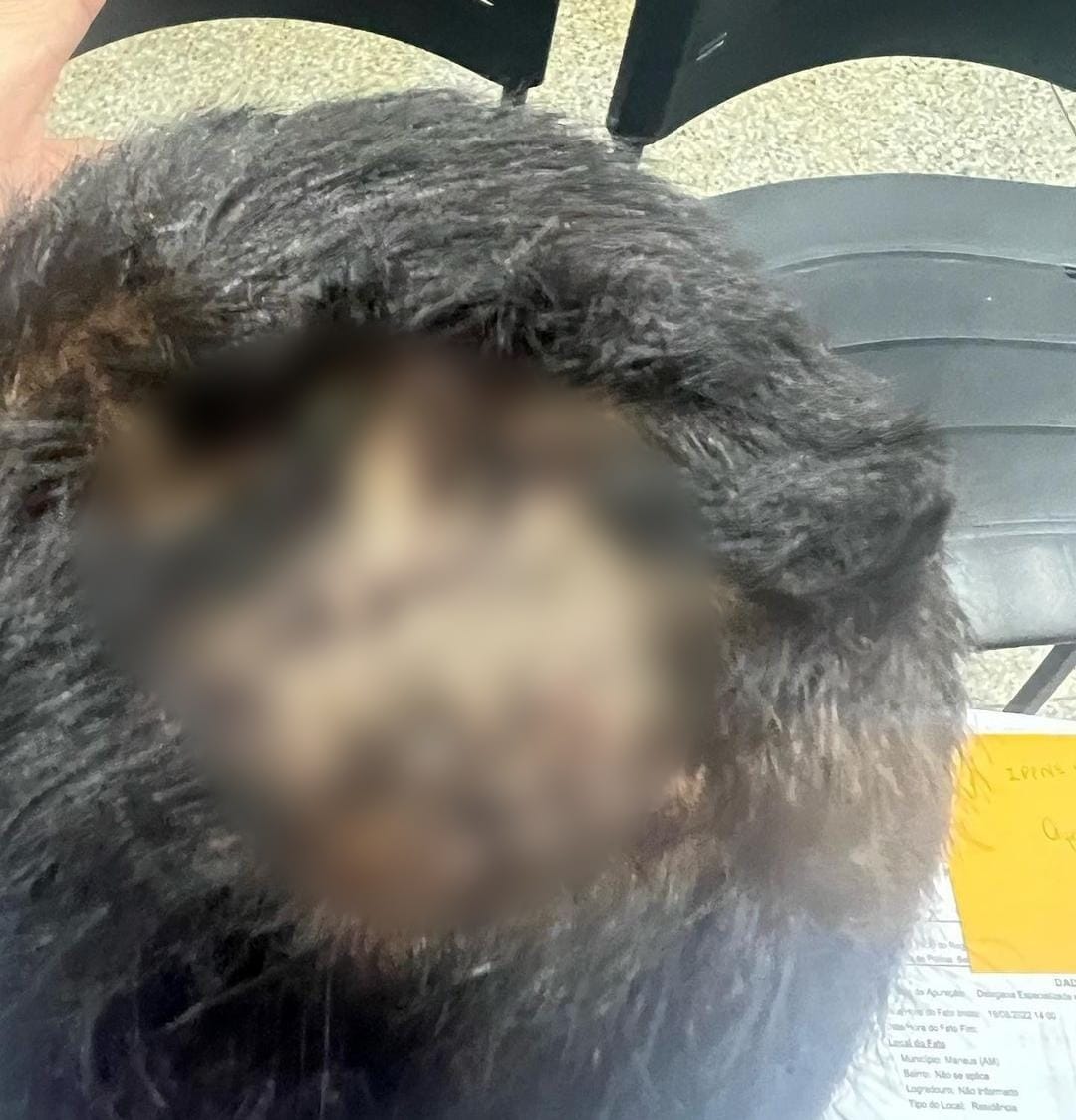 Criança tem cabeça quebrada após beber o mingau da irmã em Manaus 