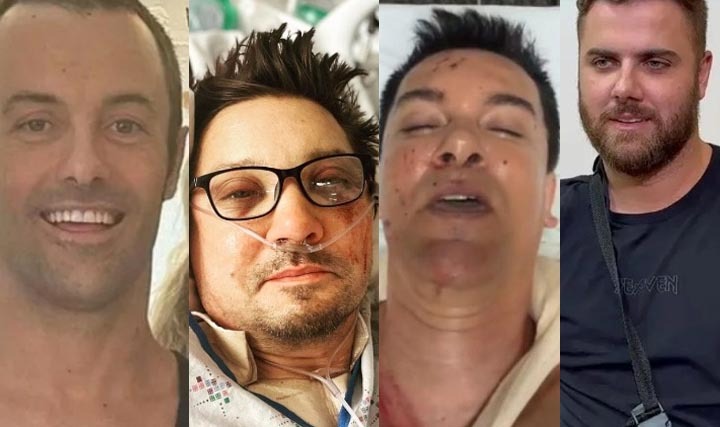 Retrospectiva 2023: Relembre os acidentes dos famosos que chocaram o público