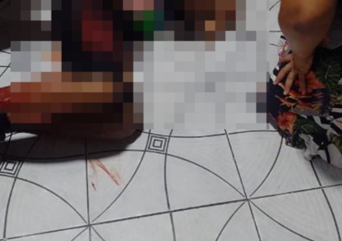 Idoso é baleado durante ataque criminoso em Manaus