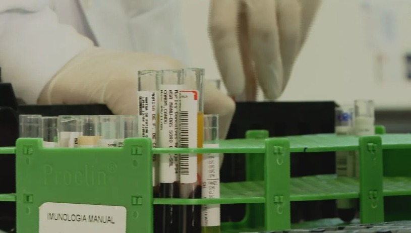 Testes de HIV são refeitos em 45 transplantados após caso de erros em exames