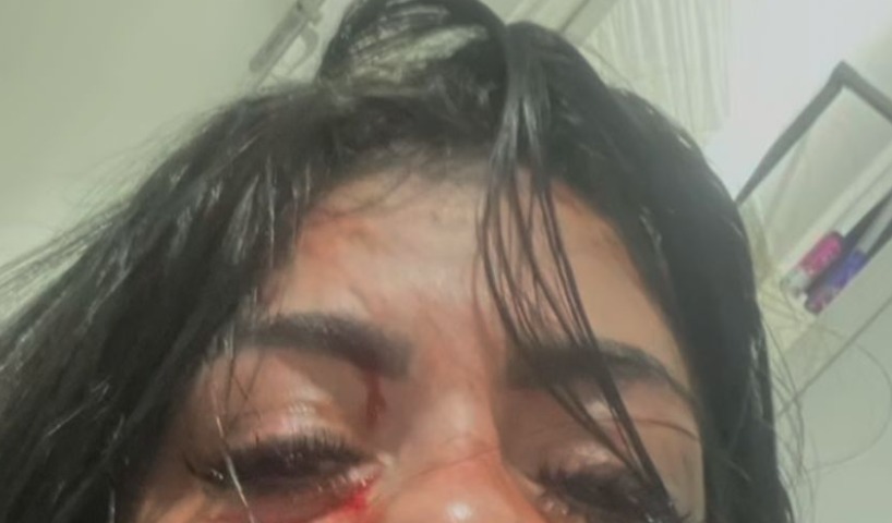 Cantor de forró é suspeito de espancar namorada em Manaus; vítima perdeu 3 dentes